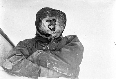 Dr. Mertz in Burberry helmet jacket early stages in formation of an ice mask